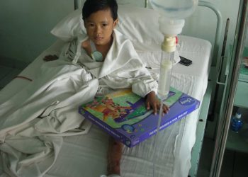 Dua Tahun Menanti, Fadil pun Diamputasi