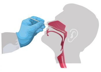 Tes Covid di Bali: Rapid Test dan Swab